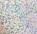 Immunohistochemical staining of NUP93 using anti-NUP93 antibody. NUP93 was detected in a paraffin-embedded section of mouse brain tissue. Heat mediated antigen retrieval was performed in EDTA buffer (pH 8.0, epitope retrieval solution). The tissue section was blocked with 10% goat serum. The tissue section was then incubated with 2 ug/ml rabbit anti-NUP93 antibody overnight at 4oC. Peroxidase Conjugated Goat Anti-rabbit IgG was used as secondary antibody and incubated for 30 minutes at 37oC. The tissue section was developed using an HRP secondary and DAB substrate.