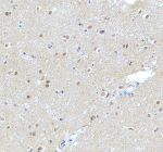 Immunohistochemical staining of NUP93 using anti-NUP93 antibody. NUP93 was detected in a paraffin-embedded section of human brain tissue. Heat mediated antigen retrieval was performed in EDTA buffer (pH 8.0, epitope retrieval solution). The tissue section was blocked with 10% goat serum. The tissue section was then incubated with 2 ug/ml rabbit anti-NUP93 antibody overnight at 4oC. Peroxidase Conjugated Goat Anti-rabbit IgG was used as secondary antibody and incubated for 30 minutes at 37oC. The tissue section was developed using an HRP secondary and DAB substrate.