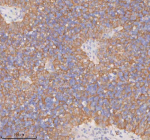 Immunohistochemical staining of RIGI using anti-RIGI antibody. RIGI was detected in a paraffin-embedded section of human spleen tissue. Heat mediated antigen retrieval was performed in EDTA buffer (pH 8.0, epitope retrieval solution). The tissue section was blocked with 10% goat serum. The tissue section was then incubated with 2 ug/ml rabbit anti-RIGI antibody overnight at 4oC. Peroxidase Conjugated Goat Anti-rabbit IgG was used as secondary antibody and incubated for 30 minutes at 37oC. The tissue section was developed using an HRP secondary and DAB substrate.