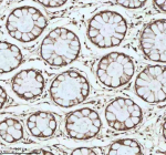Immunohistochemical staining of MYH14 using anti-MYH14 antibody. MYH14 was detected in a paraffin-embedded section of human colon tissue. Heat mediated antigen retrieval was performed in EDTA buffer (pH 8.0, epitope retrieval solution). The tissue section was blocked with 10% goat serum. The tissue section was then incubated with 2 ug/ml rabbit anti-MYH14 antibody overnight at 4oC. Peroxidase Conjugated Goat Anti-rabbit IgG was used as secondary antibody and incubated for 30 minutes at 37oC. The tissue section was developed using an HRP secondary and DAB substrate.