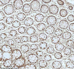 Immunohistochemical staining of MYH14 using anti-MYH14 antibody. MYH14 was detected in a paraffin-embedded section of human colon tissue. Heat mediated antigen retrieval was performed in EDTA buffer (pH 8.0, epitope retrieval solution). The tissue section was blocked with 10% goat serum. The tissue section was then incubated with 2 ug/ml rabbit anti-MYH14 antibody overnight at 4oC. Peroxidase Conjugated Goat Anti-rabbit IgG was used as secondary antibody and incubated for 30 minutes at 37oC. The tissue section was developed using an HRP secondary and DAB substrate.