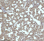 Immunohistochemical staining of MYH14 using anti-MYH14 antibody. MYH14 was detected in a paraffin-embedded section of mouse lung tissue. Heat mediated antigen retrieval was performed in EDTA buffer (pH 8.0, epitope retrieval solution). The tissue section was blocked with 10% goat serum. The tissue section was then incubated with 2 ug/ml rabbit anti-MYH14 antibody overnight at 4oC. Peroxidase Conjugated Goat Anti-rabbit IgG was used as secondary antibody and incubated for 30 minutes at 37oC. The tissue section was developed using an HRP secondary and DAB substrate.