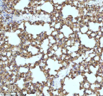 Immunohistochemical staining of MYH14 using anti-MYH14 antibody. MYH14 was detected in a paraffin-embedded section of mouse lung tissue. Heat mediated antigen retrieval was performed in EDTA buffer (pH 8.0, epitope retrieval solution). The tissue section was blocked with 10% goat serum. The tissue section was then incubated with 2 ug/ml rabbit anti-MYH14 antibody overnight at 4oC. Peroxidase Conjugated Goat Anti-rabbit IgG was used as secondary antibody and incubated for 30 minutes at 37oC. The tissue section was developed using an HRP secondary and DAB substrate.