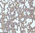 Immunohistochemical staining of MYH14 using anti-MYH14 antibody. MYH14 was detected in a paraffin-embedded section of rat lung tissue. Heat mediated antigen retrieval was performed in EDTA buffer (pH 8.0, epitope retrieval solution). The tissue section was blocked with 10% goat serum. The tissue section was then incubated with 2 ug/ml rabbit anti-MYH14 antibody overnight at 4oC. Peroxidase Conjugated Goat Anti-rabbit IgG was used as secondary antibody and incubated for 30 minutes at 37oC. The tissue section was developed using an HRP secondary and DAB substrate.