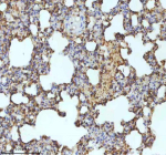 Immunohistochemical staining of MYH14 using anti-MYH14 antibody. MYH14 was detected in a paraffin-embedded section of rat lung tissue. Heat mediated antigen retrieval was performed in EDTA buffer (pH 8.0, epitope retrieval solution). The tissue section was blocked with 10% goat serum. The tissue section was then incubated with 2 ug/ml rabbit anti-MYH14 antibody overnight at 4oC. Peroxidase Conjugated Goat Anti-rabbit IgG was used as secondary antibody and incubated for 30 minutes at 37oC. The tissue section was developed using an HRP secondary and DAB substrate.