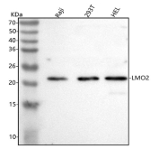 Western blot analysis of LMO2 using anti-LMO2 antibody. Lane 1: human Raji whole cell lysates, Lane 2: human 293T whole cell lysates, Lane 3: human HEL whole cell lysates. After electrophoresis, proteins were transferred to a nitrocellulose membrane at 150 mA for 50-90 minutes. Blocked the membrane with 5% non-fat milk/TBS for 1.5 hour at RT. The membrane was incubated with rabbit anti-LMO2 antibody at 0.5 ug/ml overnight at 4oC, then washed with TBS-0.1%Tween 3 times with 5 minutes each and probed with a goat anti-rabbit IgG-HRP secondary antibody at a dilution of 1:5000 for 1.5 hour at RT. The signal was developed using enhanced chemiluminescent. A specific band was detected for LMO2 at approximately 22 kDa. The expected band size for LMO2 is at 18 kDa.