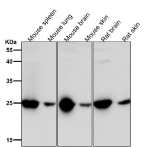 All lanes use the GRB2 antibody at 1:1K dilution for 1 hour at room temperature.