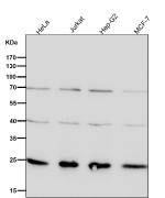All lanes use the GRB2 antibody at 1:1K dilution for 1 hour at room temperature.