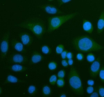 Immunofluorescent staining of GBP1 using anti-GBP1 antibody (green). GBP1 was detected in an immunocytochemical section of SiHa cells. Enzyme antigen retrieval was performed using IHC enzyme antigen retrieval reagent for 15 mins. The cells were blocked with 10% goat serum. And then incubated with 5 ug/ml rabbit anti-GBP1 antibody overnight at 4oC. DyLight 488 Conjugated Goat Anti-Rabbit IgG was used as secondary antibody at 1:500 dilution and incubated for 30 minutes at 37oC. The section was counterstained with DAPI nuclear stain (blue). Visualize using a fluorescence microscope and filter sets appropriate for the label used.