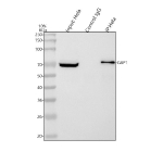 Immunoprecipitating GBP1 in Hela whole cell lysate. Western blot analysis of GBP1 using anti-GBP1 antibody. Lane 1: Hela whole cell lysates (30ug) Lane 2: Rabbit control IgG instead of anti-GBP1 antibody in Hela whole cell lysate. Lane 3: anti-GBP1 antibody (2ug) + Hela whole cell lysate (500ug) After electrophoresis, proteins were transferred to a membrane. Then the membrane was incubated with rabbit anti-GBP1 antibody at a dilution of 0.5 ug/ml and probed with a goat anti-rabbit IgG-HRP secondary antibody. The signal is developed using ECL Plus Western Blotting Substrate. A specific band was detected for GBP1 at approximately 68 kDa. The expected band size for GBP1 is at 68 kDa.