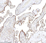 Immunohistochemical staining of RLIM using anti-RLIM antibody. RLIM was detected in a paraffin-embedded section of human placenta tissue. Heat mediated antigen retrieval was performed in EDTA buffer (pH 8.0, epitope retrieval solution). The tissue section was blocked with 10% goat serum. The tissue section was then incubated with 2 ug/ml rabbit anti-RLIM antibody overnight at 4oC. Peroxidase Conjugated Goat Anti-rabbit IgG was used as secondary antibody and incubated for 30 minutes at 37oC. The tissue section was developed using an HRP secondary and DAB substrate.