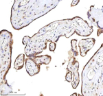 Immunohistochemical staining of RLIM using anti-RLIM antibody. RLIM was detected in a paraffin-embedded section of human placenta tissue. Heat mediated antigen retrieval was performed in EDTA buffer (pH 8.0, epitope retrieval solution). The tissue section was blocked with 10% goat serum. The tissue section was then incubated with 2 ug/ml rabbit anti-RLIM antibody overnight at 4oC. Peroxidase Conjugated Goat Anti-rabbit IgG was used as secondary antibody and incubated for 30 minutes at 37oC. The tissue section was developed using an HRP secondary and DAB substrate.