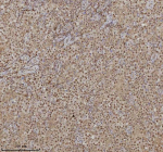 Immunohistochemical staining of RLIM using anti-RLIM antibody. RLIM was detected in a paraffin-embedded section of human testicular seminoma tissue. Heat mediated antigen retrieval was performed in EDTA buffer (pH 8.0, epitope retrieval solution). The tissue section was blocked with 10% goat serum. The tissue section was then incubated with 2 ug/ml rabbit anti-RLIM antibody overnight at 4oC. Peroxidase Conjugated Goat Anti-rabbit IgG was used as secondary antibody and incubated for 30 minutes at 37oC. The tissue section was developed using an HRP secondary and DAB substrate.