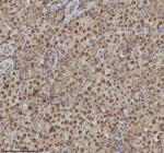 Immunohistochemical staining of RLIM using anti-RLIM antibody. RLIM was detected in a paraffin-embedded section of human testicular seminoma tissue. Heat mediated antigen retrieval was performed in EDTA buffer (pH 8.0, epitope retrieval solution). The tissue section was blocked with 10% goat serum. The tissue section was then incubated with 2 ug/ml rabbit anti-RLIM antibody overnight at 4oC. Peroxidase Conjugated Goat Anti-rabbit IgG was used as secondary antibody and incubated for 30 minutes at 37oC. The tissue section was developed using an HRP secondary and DAB substrate.