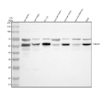 Western blot analysis of Dnmt2 using anti-Dnmt2 antibody. Electrophoresis was performed on a 10% SDS-PAGE gel at 80V (Stacking gel) / 120V (Resolving gel) for 2 hours. Lane 1: rat testis tissue lysates, Lane 2: rat ovary tissue lysates, Lane 3: rat PC-12 whole cell lysates, Lane 4: mouse testis tissue lysates, Lane 5: mouse ovary tissue lysates Lane 6: mouse thymus tissue lysates, Lane 7: mouse TM4 whole cell lysates. After electrophoresis, proteins were transferred to a nitrocellulose membrane at 150 mA for 50-90 minutes. Blocked the membrane with 5% non-fat milk/TBS for 1.5 hour at RT. The membrane was incubated with rabbit anti-Dnmt2 antibody at 0.5 ug/ml overnight at 4oC, then washed with TBS-0.1%Tween 3 times with 5 minutes each and probed with a goat anti-rabbit IgG-HRP secondary antibody at a dilution of 1:5000 for 1.5 hour at RT. The signal was developed using an ECL Plus Western Blotting Substrate. The expected band size for Dnmt2 is at 47 kDa.