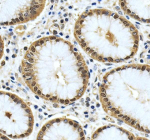 Immunohistochemical staining of YWHAH using anti-YWHAH antibody. YWHAH was detected in a paraffin-embedded section of human stomach tissue. Heat mediated antigen retrieval was performed in EDTA buffer (pH 8.0, epitope retrieval solution). The tissue section was blocked with 10% goat serum. The tissue section was then incubated with 2 ug/ml rabbit anti-YWHAH antibody overnight at 4oC. Peroxidase Conjugated Goat Anti-rabbit IgG was used as secondary antibody and incubated for 30 minutes at 37oC. The tissue section was developed using an HRP secondary and DAB substrate.
