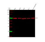 Western blot analysis of PLS3 using anti-PLS3 antibody. Lane 1: human Hela whole cell lysates, Lane 2: human whole cell lysates, Lane 3: human SiHa whole cell lysates, Lane 4: human PC-3 whole cell lysates, Lane 5: mouse pancreas tissue lysates. After electrophoresis, proteins were transferred to a nitrocellulose membrane at 150 mA for 50-90 minutes. Blocked the membrane with 5% non-fat milk/TBS for 1.5 hour at RT. The membrane was incubated with rabbit anti-PLS3 antibody at 0.25 ug/ml overnight at 4oC, then washed with TBS-0.1%Tween 3 times with 5 minutes each and probed with a goat anti-rabbit IgG-DyLight 647 Conjugated secondary antibody at a dilution of 1:2000 for 1.5 hour at RT. A specific band was detected for PLS3 at approximately 71 kDa. The expected band size for PLS3 is at 71 kDa.