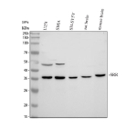 Western blot analysis of Serine racemase/ SRR using anti-Serine racemase antibody. Electrophoresis was performed on a 10% SDS-PAGE gel at 80V (Stacking gel) / 120V (Resolving gel) for 2-3 hours. Lane 1: human U251 whole cell lysates, Lane 2: human SiHa whole cell lysates, Lane 3: human SH-SY5Y whole cell lysates, Lane 4: rat brain tissue lysates, Lane 5: mouse brain tissue lysates. After electrophoresis, proteins were transferred to a nitrocellulose membrane at 150 mA for 50-90 minutes. Blocked the membrane with 5% non-fat milk/TBS for 1.5 hour at RT. The membrane was incubated with rabbit anti-Serine racemase antibody at 0.5 ug/ml overnight at 4oC, then washed with TBS-0.1%Tween 3 times with 5 minutes each and probed with a goat anti-rabbit IgG-HRP secondary antibody at a dilution of 1:5000 for 1.5 hour at RT. The signal was developed using an ECL Plus Western Blotting Substrate. A specific band was detected for Serine racemase at approximately 37 kDa. The expected band size for Serine racemase is at 37 kDa.