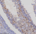 Immunohistochemical staining of TMEM175 using anti-TMEM175 antibody. TMEM175 was detected in a paraffin-embedded section of mouse testis tissue. Heat mediated antigen retrieval was performed in EDTA buffer (pH 8.0, epitope retrieval solution). The tissue section was blocked with 10% goat serum. The tissue section was then incubated with 2 ug/ml rabbit anti-TMEM175 antibody overnight at 4oC. Peroxidase Conjugated Goat Anti-rabbit IgG was used as secondary antibody and incubated for 30 minutes at 37oC. The tissue section was developed using an HRP secondary and DAB substrate.
