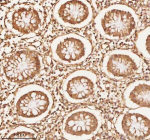 Immunohistochemical staining of NUP43 using anti-NUP43 antibody. NUP43 was detected in a paraffin-embedded section of human colon tissue. Heat mediated antigen retrieval was performed in EDTA buffer (pH 8.0, epitope retrieval solution). The tissue section was blocked with 10% goat serum. The tissue section was then incubated with 2 ug/ml rabbit anti-NUP43 antibody overnight at 4oC. Peroxidase Conjugated Goat Anti-rabbit IgG was used as secondary antibody and incubated for 30 minutes at 37oC. The tissue section was developed using an HRP secondary and DAB substrate.