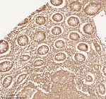 Immunohistochemical staining of NUP43 using anti-NUP43 antibody. NUP43 was detected in a paraffin-embedded section of human colon tissue. Heat mediated antigen retrieval was performed in EDTA buffer (pH 8.0, epitope retrieval solution). The tissue section was blocked with 10% goat serum. The tissue section was then incubated with 2 ug/ml rabbit anti-NUP43 antibody overnight at 4oC. Peroxidase Conjugated Goat Anti-rabbit IgG was used as secondary antibody and incubated for 30 minutes at 37oC. The tissue section was developed using an HRP secondary and DAB substrate.