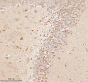 Immunohistochemical staining of NUP43 using anti-NUP43 antibody. NUP43 was detected in a paraffin-embedded section of rat brain tissue. Heat mediated antigen retrieval was performed in EDTA buffer (pH 8.0, epitope retrieval solution). The tissue section was blocked with 10% goat serum. The tissue section was then incubated with 2 ug/ml rabbit anti-NUP43 antibody overnight at 4oC. Peroxidase Conjugated Goat Anti-rabbit IgG was used as secondary antibody and incubated for 30 minutes at 37oC. The tissue section was developed using an HRP secondary and DAB substrate.