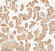 Immunohistochemical staining of NUP43 using anti-NUP43 antibody. NUP43 was detected in a paraffin-embedded section of human placenta tissue. Heat mediated antigen retrieval was performed in EDTA buffer (pH 8.0, epitope retrieval solution). The tissue section was blocked with 10% goat serum. The tissue section was then incubated with 2 ug/ml rabbit anti-NUP43 antibody overnight at 4oC. Peroxidase Conjugated Goat Anti-rabbit IgG was used as secondary antibody and incubated for 30 minutes at 37oC. The tissue section was developed using an HRP secondary and DAB substrate.
