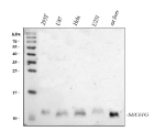 Western blot analysis of SEC61G using anti-SEC61G antibody. Lane 1: human 293T whole cell lysates, Lane 2: human U87 whole cell lysates, Lane 3: human Hela whole cell lysates, Lane 4: human U251 whole cell lysates, Lane 5: rat liver tissue lysates. After electrophoresis, proteins were transferred to a nitrocellulose membrane at 150 mA for 50-90 minutes. Blocked the membrane with 5% non-fat milk/TBS for 1.5 hour at RT. The membrane was incubated with rabbit anti-SEC61G antibody at 0.5 ug/ml overnight at 4oC, then washed with TBS-0.1%Tween 3 times with 5 minutes each and probed with a goat anti-rabbit IgG-HRP secondary antibody at a dilution of 1:5000 for 1.5 hour at RT. The signal was developed using enhanced chemiluminescent. The expected band size for SEC61G is at 8 kDa.