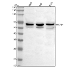 Western blot analysis of PFKFB4 using anti-PFKFB4 antibody. Lane 1: human 293T whole cell lysates, Lane 2: human Raji whole cell lysates, Lane 3: human PC-3 whole cell lysates. After electrophoresis, proteins were transferred to a nitrocellulose membrane at 150 mA for 50-90 minutes. Blocked the membrane with 5% non-fat milk/TBS for 1.5 hour at RT. The membrane was incubated with rabbit anti-PFKFB4 antibody at 0.5 ug/ml overnight at 4oC, then washed with TBS-0.1%Tween 3 times with 5 minutes each and probed with a goat anti-rabbit IgG-HRP secondary antibody at a dilution of 1:5000 for 1.5 hour at RT. The signal was developed using enhanced chemiluminescent. A specific band was detected for PFKFB4 at approximately 54 kDa. The expected band size for PFKFB4 is at 54 kDa.
