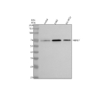 Western blot analysis of MBTD1 using anti-MBTD1 antibody. Lane 1: human Jurkat whole cell lysates, Lane 2: human K562 whole cell lysates, Lane 3: human SH-SY5Y whole cell lysates. After electrophoresis, proteins were transferred to a nitrocellulose membrane at 150 mA for 50-90 minutes. Blocked the membrane with 5% non-fat milk/TBS for 1.5 hour at RT. The membrane was incubated with rabbit anti-MBTD1 antibody at 0.5 ug/ml overnight at 4oC, then washed with TBS-0.1%Tween 3 times with 5 minutes each and probed with a goat anti-rabbit IgG-HRP secondary antibody at a dilution of 1:5000 for 1.5 hour at RT. The signal was developed using enhanced chemiluminescent. A specific band was detected for MBTD1 at approximately 71 kDa. The expected band size for MBTD1 is at 71 kDa.