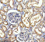 Immunohistochemical staining of TRIM10 using anti-TRIM10 antibody. TRIM10 was detected in a paraffin-embedded section of human kidney tissue. Heat mediated antigen retrieval was performed in EDTA buffer (pH 8.0, epitope retrieval solution). The tissue section was blocked with 10% goat serum. The tissue section was then incubated with 2 ug/ml rabbit anti-TRIM10 antibody overnight at 4oC. Peroxidase Conjugated Goat Anti-rabbit IgG was used as secondary antibody and incubated for 30 minutes at 37oC. The tissue section was developed using an HRP secondary and DAB substrate.