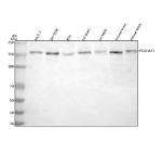 Western blot analysis of PCDHA11 using anti-PCDHA11 antibody. Lane 1: human MCF-7 whole cell lysates, Lane 2: human SH-SY5Y whole cell lysates, Lane 3: human RT4 whole cell lysates, Lane 4: rat brain tissue lysates, Lane 5: rat testis tissue lysates, Lane 6: mouse brain tissue lysates, Lane 7: mouse testis tissue lysates. After electrophoresis, proteins were transferred to a nitrocellulose membrane at 150 mA for 50-90 minutes. Blocked the membrane with 5% non-fat milk/TBS for 1.5 hour at RT. The membrane was incubated with rabbit anti-PCDHA11 antibody at 0.5 ug/ml overnight at 4oC, then washed with TBS-0.1%Tween 3 times with 5 minutes each and probed with a goat anti-rabbit IgG-HRP secondary antibody at a dilution of 1:5000 for 1.5 hour at RT. The signal was developed using enhanced chemiluminescent. A specific band was detected for PCDHA11 at approximately 150-170 kDa. The expected band size for PCDHA11 is at 103 and 88 kDa but may be observed at higher molecular weights due to glycosylation.