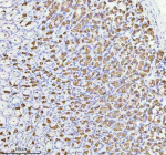 Immunohistochemical staining of ATP4B using anti-ATP4B antibody. ATP4B was detected in a paraffin-embedded section of rat stomach tissue. Heat mediated antigen retrieval was performed in EDTA buffer (pH 8.0, epitope retrieval solution). The tissue section was blocked with 10% goat serum. The tissue section was then incubated with 2 ug/ml rabbit anti-ATP4B antibody overnight at 4oC. Peroxidase Conjugated Goat Anti-rabbit IgG was used as secondary antibody and incubated for 30 minutes at 37oC. The tissue section was developed using an HRP secondary and DAB substrate.