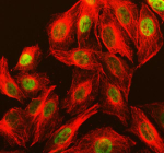 Immunofluorescent staining of NASP using anti-NASP antibody (green) and anti-Tubulin Alpha antibody (red). NASP was detected in immunocytochemical section of U2OS cell. Enzyme antigen retrieval was performed using IHC enzyme antigen retrieval reagent for 15 mins. The cells were blocked with 10% goat serum. And then incubated with 5 ug/ml rabbit anti-NASP antibody and mouse anti-Tubulin Alpha antibody overnight at 4oC. DyLight 488 Conjugated Goat Anti-Rabbit IgG and Cy3 Conjugated Goat Anti-Mouse IgG were used as secondary antibody at 1:500 dilution and incubated for 30 minutes at 37oC. Visualize using a fluorescence microscope and filter sets appropriate for the label used.