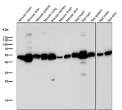 All lanes use the ALDH2 antibody at 1:3K dilution for 1 hour at room temperature.