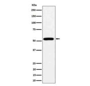 Western blot analysis of ALDH2 expression in HepG2 cell lysate using ALDH2 antibody.