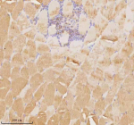 Immunohistochemical staining of MAP4K3 using anti-MAP4K3 antibody. MAP4K3 was detected in a paraffin-embedded section of human skeletal muscle tissue. Heat mediated antigen retrieval was performed in EDTA buffer (pH 8.0, epitope retrieval solution). The tissue section was blocked with 10% goat serum. The tissue section was then incubated with 2 ug/ml rabbit anti-MAP4K3 antibody overnight at 4oC. Peroxidase Conjugated Goat Anti-rabbit IgG was used as secondary antibody and incubated for 30 minutes at 37oC. The tissue section was developed using an HRP secondary and DAB substrate.