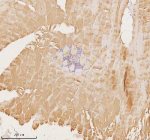 Immunohistochemical staining of MAP4K3 using anti-MAP4K3 antibody. MAP4K3 was detected in a paraffin-embedded section of human skeletal muscle tissue. Heat mediated antigen retrieval was performed in EDTA buffer (pH 8.0, epitope retrieval solution). The tissue section was blocked with 10% goat serum. The tissue section was then incubated with 2 ug/ml rabbit anti-MAP4K3 antibody overnight at 4oC. Peroxidase Conjugated Goat Anti-rabbit IgG was used as secondary antibody and incubated for 30 minutes at 37oC. The tissue section was developed using an HRP secondary and DAB substrate.
