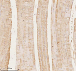 Immunohistochemical staining of MAP4K3 using anti-MAP4K3 antibody. MAP4K3 was detected in a paraffin-embedded section of human skeletal muscle tissue. Heat mediated antigen retrieval was performed in EDTA buffer (pH 8.0, epitope retrieval solution). The tissue section was blocked with 10% goat serum. The tissue section was then incubated with 2 ug/ml rabbit anti-MAP4K3 antibody overnight at 4oC. Peroxidase Conjugated Goat Anti-rabbit IgG was used as secondary antibody and incubated for 30 minutes at 37oC. The tissue section was developed using an HRP secondary and DAB substrate.