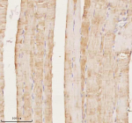 Immunohistochemical staining of MAP4K3 using anti-MAP4K3 antibody. MAP4K3 was detected in a paraffin-embedded section of human skeletal muscle tissue. Heat mediated antigen retrieval was performed in EDTA buffer (pH 8.0, epitope retrieval solution). The tissue section was blocked with 10% goat serum. The tissue section was then incubated with 2 ug/ml rabbit anti-MAP4K3 antibody overnight at 4oC. Peroxidase Conjugated Goat Anti-rabbit IgG was used as secondary antibody and incubated for 30 minutes at 37oC. The tissue section was developed using an HRP secondary and DAB substrate.