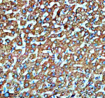 Immunohistochemical staining of SMG8 using anti-SMG8 antibody. SMG8 was detected in a paraffin-embedded section of human liver tissue. Heat mediated antigen retrieval was performed in EDTA buffer (pH 8.0, epitope retrieval solution). The tissue section was blocked with 10% goat serum. The tissue section was then incubated with 2 ug/ml rabbit anti-SMG8 antibody overnight at 4oC. Peroxidase Conjugated Goat Anti-rabbit IgG was used as secondary antibody and incubated for 30 minutes at 37oC. The tissue section was developed using an HRP secondary and DAB substrate.