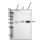 Western blot analysis of NRTN using anti-NRTN antibody. Lane 1: human SH-SY5Y whole cell lysates, Lane 2: human 293T whole cell lysates, Lane 3: mouse heart tissue lysates. After electrophoresis, proteins were transferred to a nitrocellulose membrane at 150 mA for 50-90 minutes. Blocked the membrane with 5% non-fat milk/TBS for 1.5 hour at RT. The membrane was incubated with rabbit anti-NRTN antibody at 0.5 ug/ml overnight at 4oC, then washed with TBS-0.1%Tween 3 times with 5 minutes each and probed with a goat anti-rabbit IgG-HRP secondary antibody at a dilution of 1:5000 for 1.5 hour at RT. The signal was developed using enhanced chemiluminescent. A specific band was detected for NRTN at approximately 22 kDa. The expected band size for NRTN is at 22 kDa.