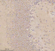Immunohistochemical staining of NRTN using anti-NRTN antibody. NRTN was detected in a paraffin-embedded section of rat brain tissue. Heat mediated antigen retrieval was performed in EDTA buffer (pH 8.0, epitope retrieval solution). The tissue section was blocked with 10% goat serum. The tissue section was then incubated with 2 ug/ml rabbit anti-NRTN antibody overnight at 4oC. Peroxidase Conjugated Goat Anti-rabbit IgG was used as secondary antibody and incubated for 30 minutes at 37oC. The tissue section was developed using an HRP secondary and DAB substrate.