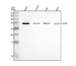 Western blot analysis of CD69 using anti-CD69 antibody. Lane 1: human K562 whole cell lysates, Lane 2: human Jurkat whole cell lysates, Lane 3: human HEL whole cell lysates, Lane 4: human RT4 whole cell lysates. After electrophoresis, proteins were transferred to a nitrocellulose membrane at 150 mA for 50-90 minutes. Blocked the membrane with 5% non-fat milk/TBS for 1.5 hour at RT. The membrane was incubated with rabbit anti-CD69 antibody at 0.5 ug/ml overnight at 4oC, then washed with TBS-0.1%Tween 3 times with 5 minutes each and probed with a goat anti-rabbit IgG-HRP secondary antibody at a dilution of 1:5000 for 1.5 hour at RT. The signal was developed using enhanced chemiluminescent. The expected band size for CD69 is at 23 kDa but may be observed at higher molecular weights due to glycosylation.