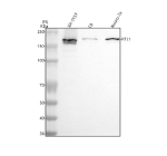 Western blot analysis of RTL1 using anti-RTL1 antibody. Lane 1: human SH-SY5Y whole cell lysates, Lane 2: rat C6 whole cell lysates, Lane 3: mouse Neuro-2a whole cell lysates. After electrophoresis, proteins were transferred to a nitrocellulose membrane at 150 mA for 50-90 minutes. Blocked the membrane with 5% non-fat milk/TBS for 1.5 hour at RT. The membrane was incubated with rabbit anti-RTL1 antibody at 0.5 ug/ml overnight at 4oC, then washed with TBS-0.1%Tween 3 times with 5 minutes each and probed with a goat anti-rabbit IgG-HRP secondary antibody at a dilution of 1:5000 for 1.5 hour at RT. The signal was developed using enhanced chemiluminescent. The expected band size for RTL1 is at 155 kDa.