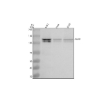 Western blot analysis of PARG using anti-PARG antibody. Electrophoresis was performed on a 8% SDS-PAGE gel at 80V (Stacking gel) / 120V (Resolving gel) for 2 hours. Lane 1: human K562 whole cell lysates, Lane 2: human Hela whole cell lysates, Lane 3: human whole cell lysates. After electrophoresis, proteins were transferred to a nitrocellulose membrane at 150 mA for 50-90 minutes. Blocked the membrane with 5% non-fat milk/TBS for 1.5 hour at RT. The membrane was incubated with rabbit anti-PARG antibody at 0.5 ug/ml overnight at 4oC, then washed with TBS-0.1%Tween 3 times with 5 minutes each and probed with a goat anti-rabbit IgG-HRP secondary antibody at a dilution of 1:5000 for 1.5 hour at RT. The signal was developed using an ECL Plus Western Blotting Substrate. The expected molecular weight of PARG is 55-111 kDa (multiple isoforms). The doublet likely reflects closely related splice variants or post-translational modifications of PARG.