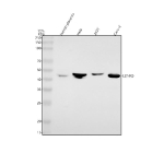 Western blot analysis of EDNRB using anti-EDNRB antibody. Lane 1: human placenta tissue lysates, Lane 2: human Hela whole cell lysates, Lane 3: human 293T whole cell lysates, Lane 4: human Caco-2 whole cell lysates. After electrophoresis, proteins were transferred to a nitrocellulose membrane at 150 mA for 50-90 minutes. Blocked the membrane with 5% non-fat milk/TBS for 1.5 hour at RT. The membrane was incubated with rabbit anti-EDNRB antibody at 0.5 ug/ml overnight at 4oC, then washed with TBS-0.1%Tween 3 times with 5 minutes each and probed with a goat anti-rabbit IgG-HRP secondary antibody at a dilution of 1:5000 for 1.5 hour at RT. The signal was developed using enhanced chemiluminescent. Expected molecular weight of EDNRB is ~49â59 kDa (predicted), but the receptor consistently migrates around ~45 kDa on SDS-PAGE, often appearing as a single or doublet band depending on glycosylation state. This pattern is well-documented in peer-reviewed studies.