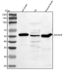 Western blot analysis of Smad9 using anti-Smad9 antibody. Lane 1: rat brain tissue lysates, Lane 2: rat C6 whole cell lysates, Lane 3: mouse brain tissue lysates. After electrophoresis, proteins were transferred to a nitrocellulose membrane at 150 mA for 50-90 minutes. Blocked the membrane with 5% non-fat milk/TBS for 1.5 hour at RT. The membrane was incubated with rabbit anti-Smad9 antibody at 0.5 ug/ml overnight at 4oC, then washed with TBS-0.1%Tween 3 times with 5 minutes each and probed with a goat anti-rabbit IgG-HRP secondary antibody at a dilution of 1:5000 for 1.5 hour at RT. The signal was developed using enhanced chemiluminescent. The expected molecular weight of Smad9 is ~49 kDa.