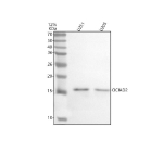 Western blot analysis of OCIAD2 using anti-OCIAD2 antibody. Lane 1: human U251 whole cell lysates, Lane 2: human U20S whole cell lysates. After electrophoresis, proteins were transferred to a nitrocellulose membrane at 150 mA for 50-90 minutes. Blocked the membrane with 5% non-fat milk/TBS for 1.5 hour at RT. The membrane was incubated with rabbit anti-OCIAD2 antibody at 0.5 ug/ml overnight at 4oC, then washed with TBS-0.1%Tween 3 times with 5 minutes each and probed with a goat anti-rabbit IgG-HRP secondary antibody at a dilution of 1:5000 for 1.5 hour at RT. The signal was developed using enhanced chemiluminescent. The expected molecular weight of OCIAD2 is ~17 kDa.