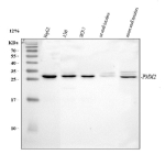 Western blot analysis of PMM2 using anti-PMM2 antibody. Lane 1: human HepG2 whole cell lysates, Lane 2: human whole cell lysates, Lane 3: human MCF-7 whole cell lysates, Lane 4: rat small intestines tissue lysates, Lane 5: mouse small intestines tissue lysates. After electrophoresis, proteins were transferred to a nitrocellulose membrane at 150 mA for 50-90 minutes. Blocked the membrane with 5% non-fat milk/TBS for 1.5 hour at RT. The membrane was incubated with rabbit anti-PMM2 antibody at 0.5 ug/ml overnight at 4oC, then washed with TBS-0.1%Tween 3 times with 5 minutes each and probed with a goat anti-rabbit IgG-HRP secondary antibody at a dilution of 1:5000 for 1.5 hour at RT. The signal was developed using enhanced chemiluminescent. The expected molecular weight of PMM2 is ~28 kDa.